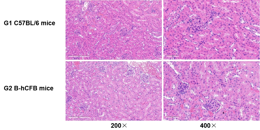 B-hCFB Mice - Biocytogen