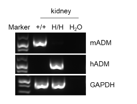 B-hADM mice mRNA expression analysis