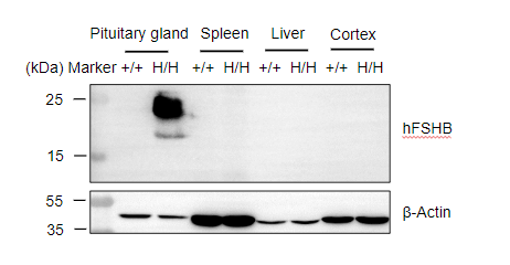 B-hFSHB mice Protein expression analysis